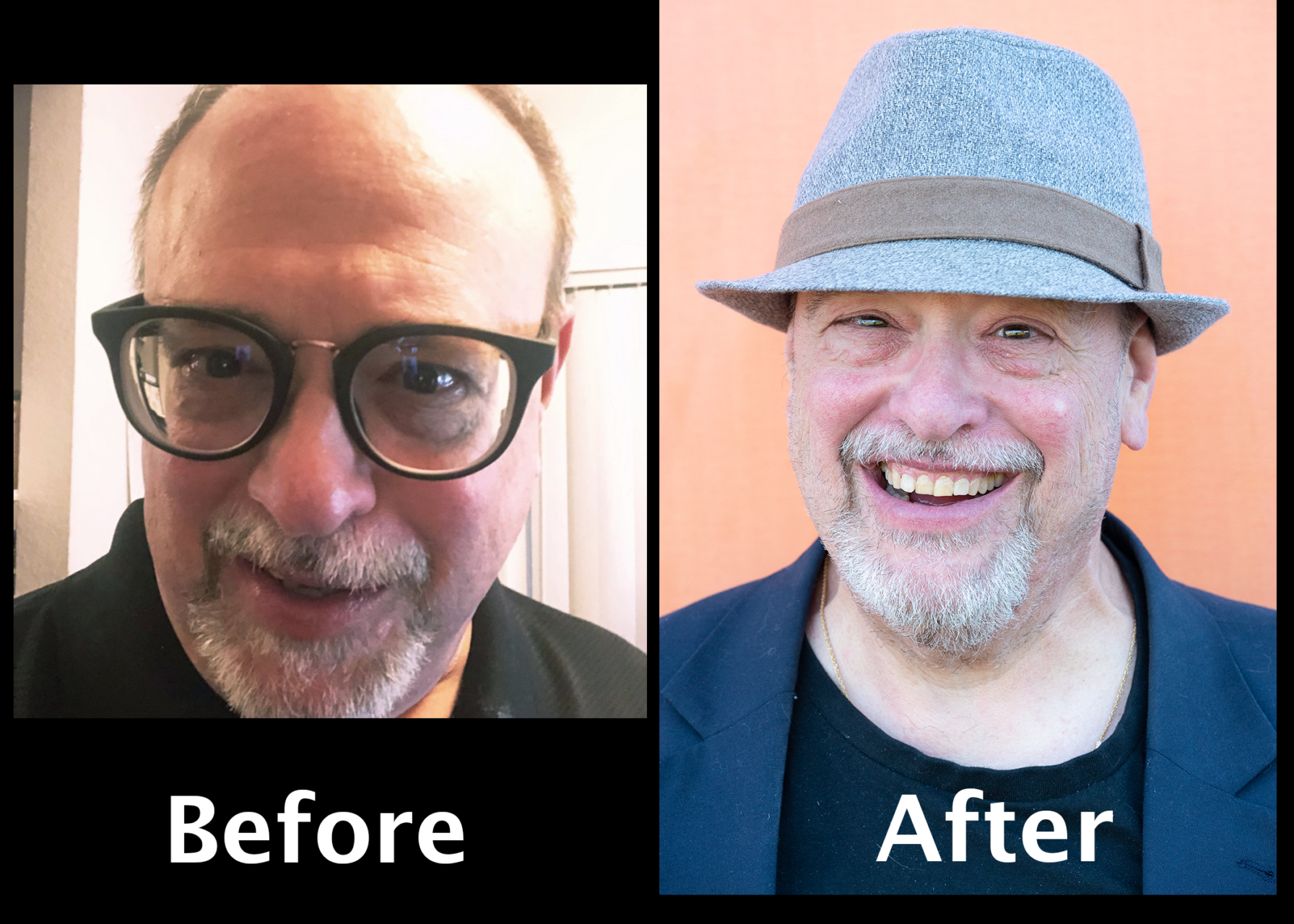 Before After_Jeff L